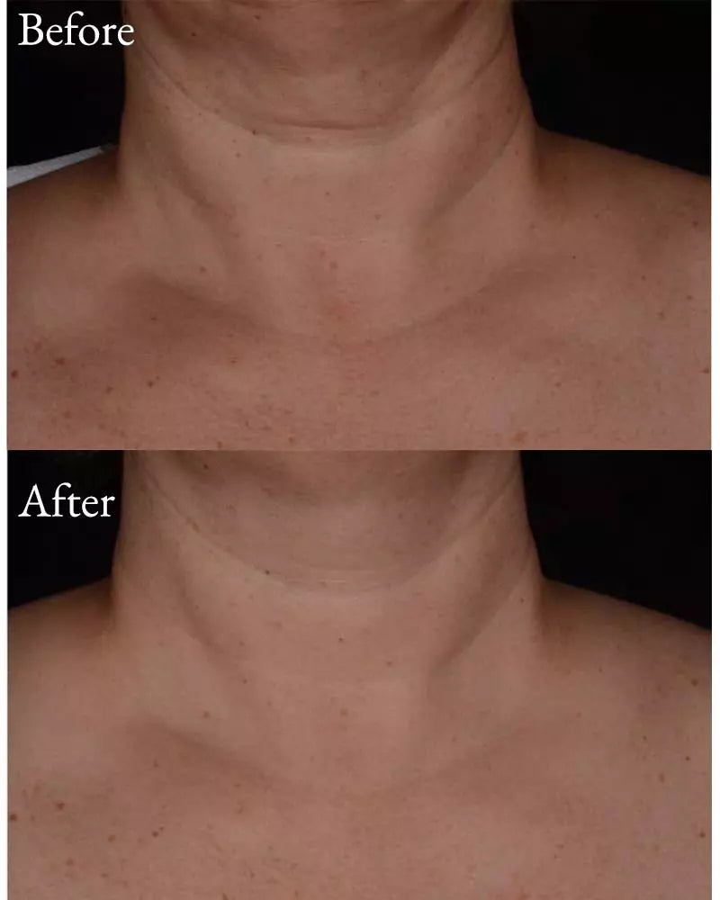 Alphascience-Alphascience Ultra Firm 50mL-Yüz Kremi-2-Milagron.com