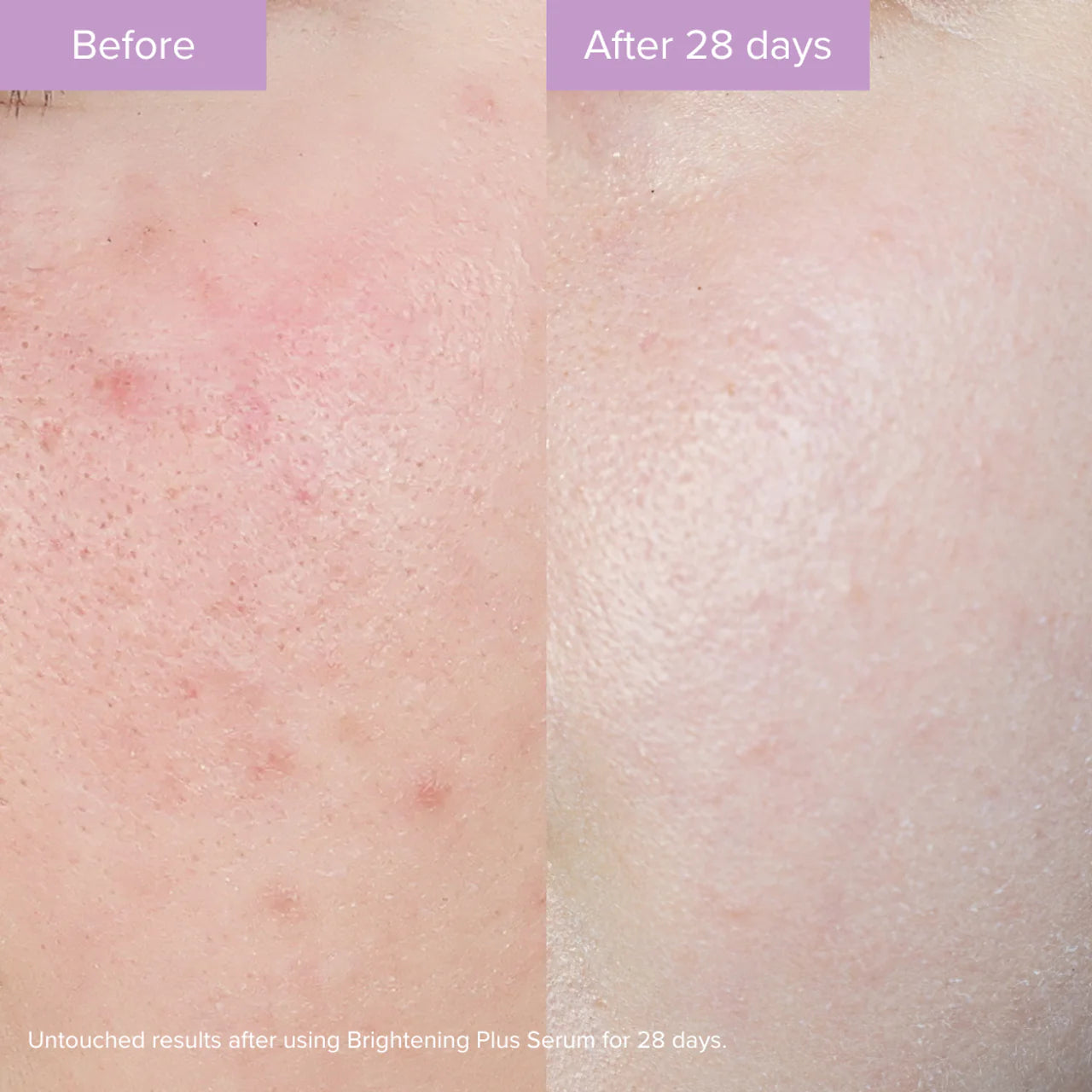 Brightening Plus Serum - Aydınlatıcı Etkili Bakım Serumu 35Ml