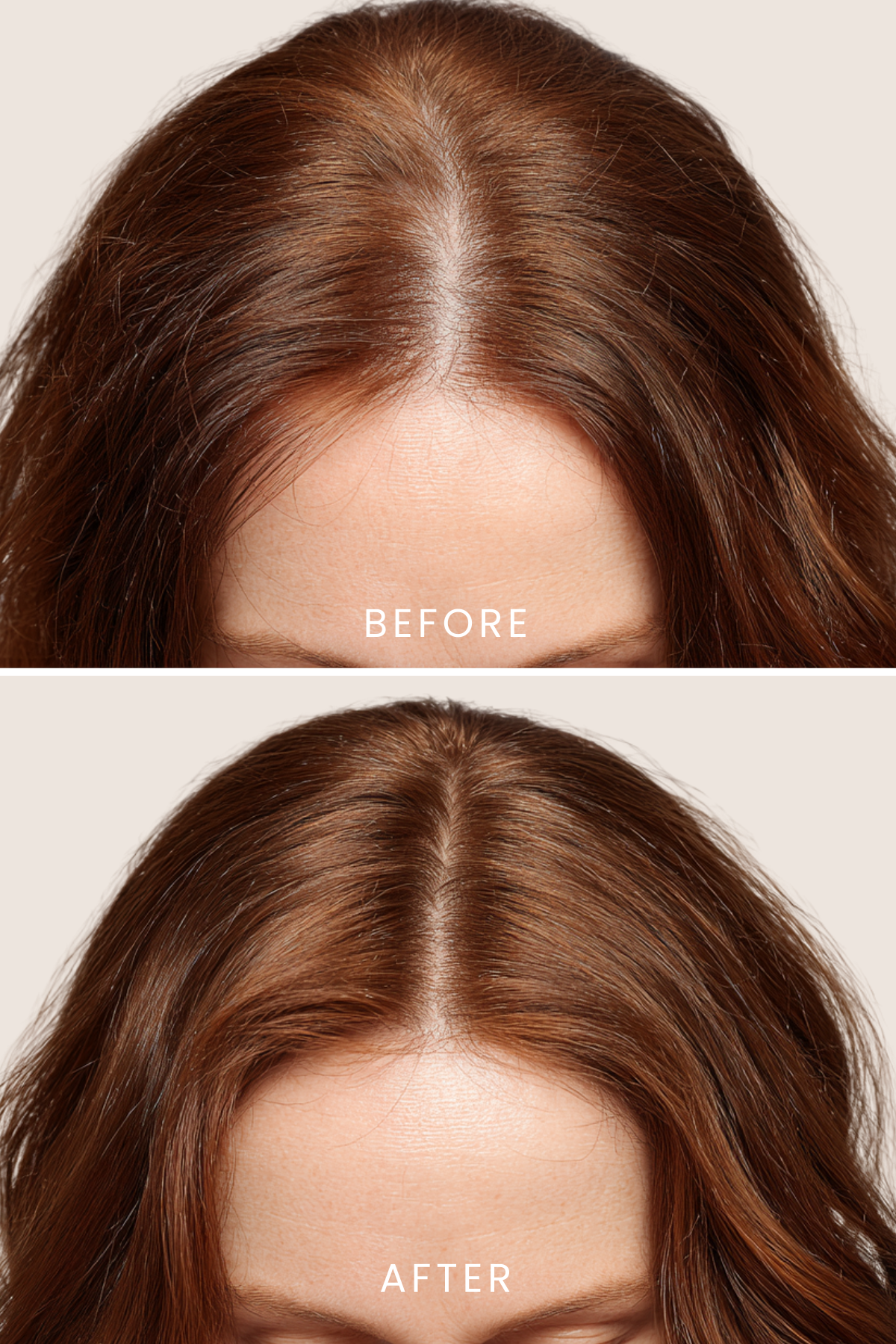 Scalpify Saç Toniği | Dökülme Karşıtı & Hacim Destekleyici Biberiye + Spirulina + Vitamin Kompleksi