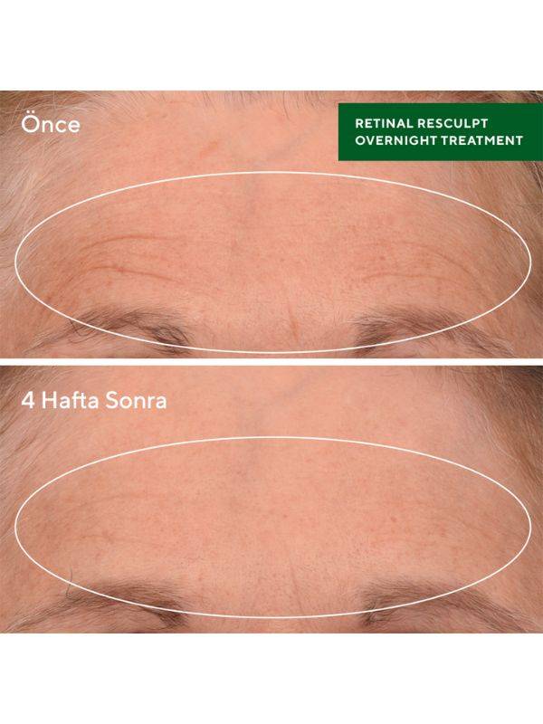 Murad Retinal Resculpt Overnight Treatment