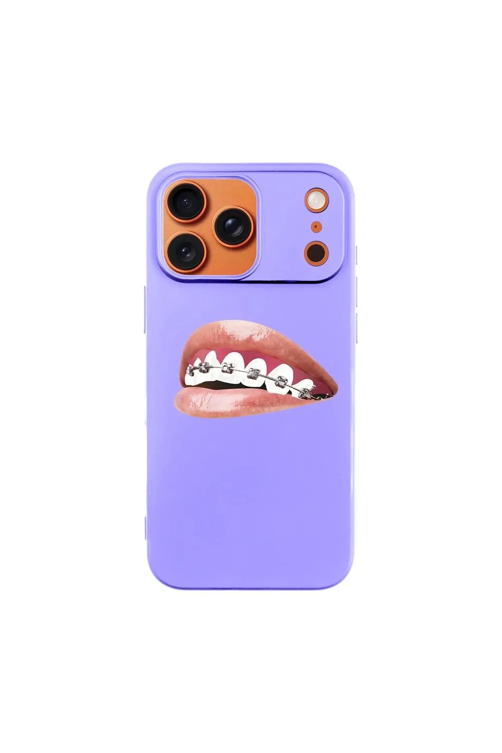 Orthodontist-Ultra Silikon Kılıf-Iphone 17 Pro Max - 6