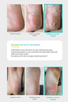 Ariul-Çorap Tipi Ayak Peeling Maskesi 2 Çift-Peeling-5-Milagron.com