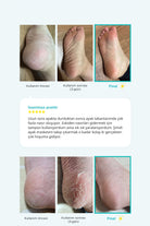 Ariul-Çorap Tipi Ayak Peeling Maskesi 2 Çift-Peeling-6-Milagron.com