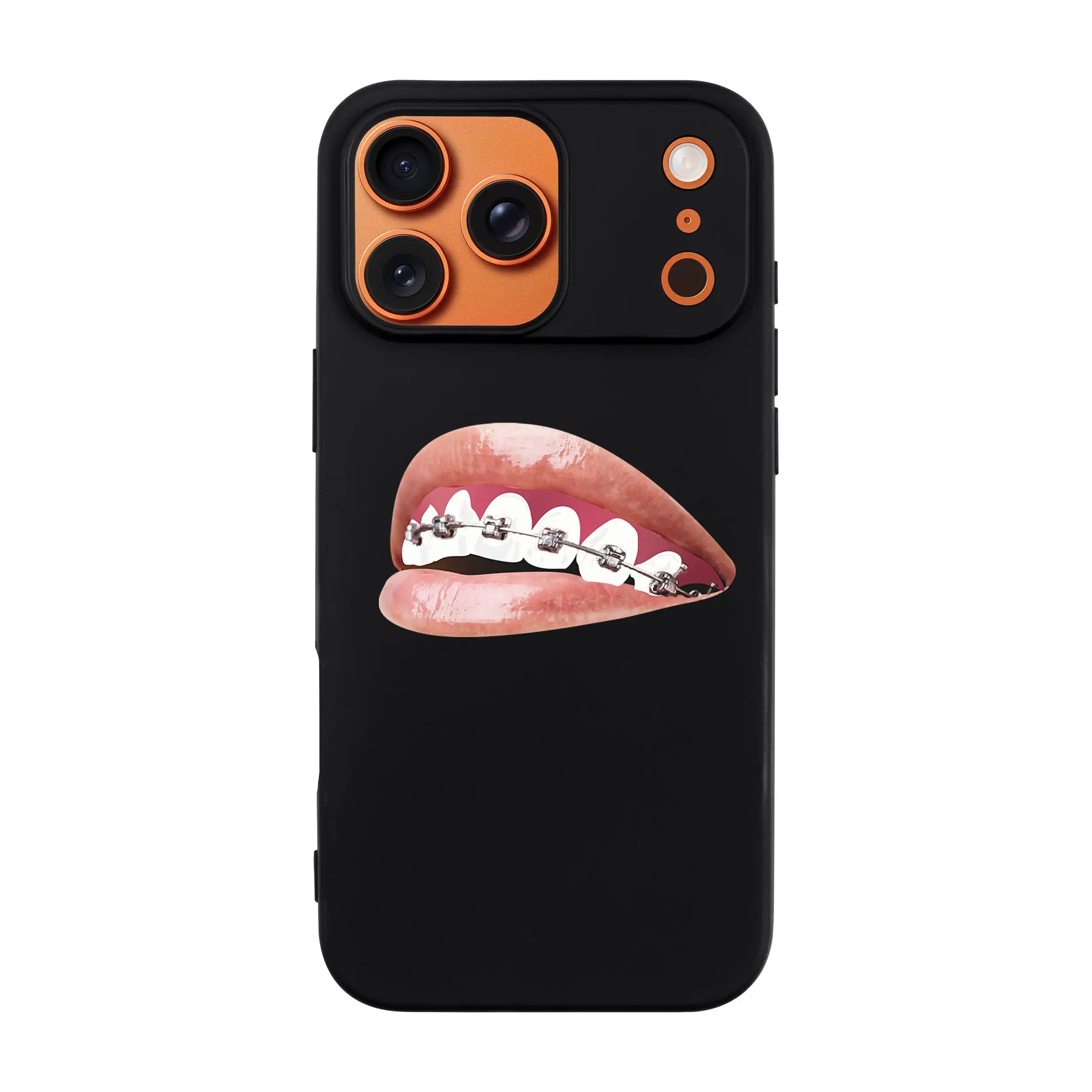 Orthodontist-Ultra Silikon Kılıf-Iphone 17