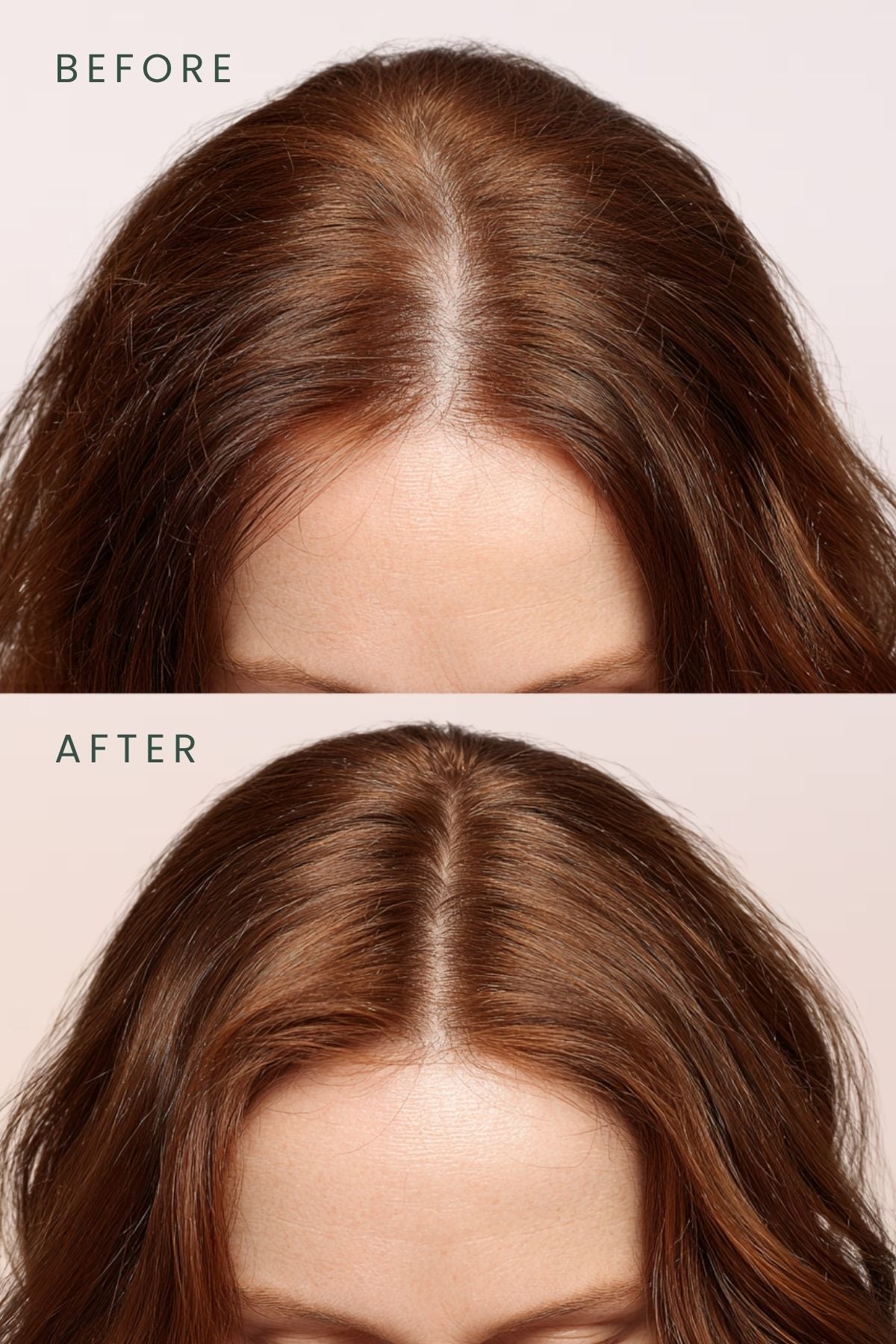 Matsu-Scalpify Saç Derisi Serumu | Dökülme Önleyici & Folikül Güçlendirici Biberiye + Biotin + Peptit-Saç Serumu-4-Milagron.com