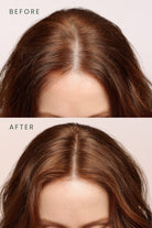 Matsu-Scalpify Saç Derisi Serumu | Dökülme Önleyici & Folikül Güçlendirici Biberiye + Biotin + Peptit-Saç Serumu-4-Milagron.com