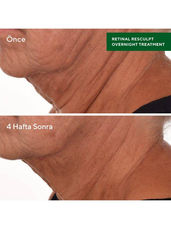 Murad Retinal Resculpt Overnight Treatment